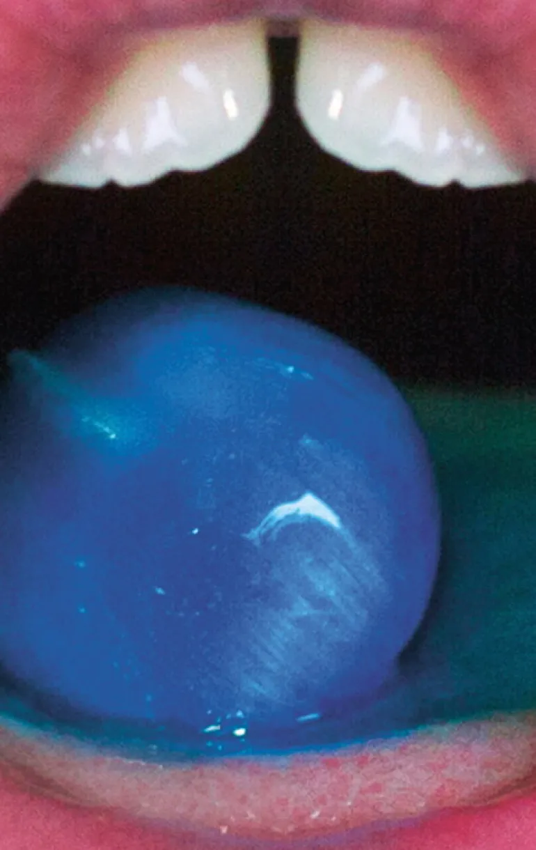 Kehrer Verlag I Was An Apple And I Got Peeled But It Was A Good Thing